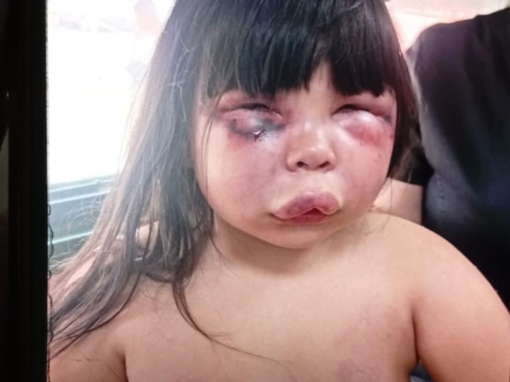 Violencia patriarcal en Gerli: padrastro agrede brutalmente a niña