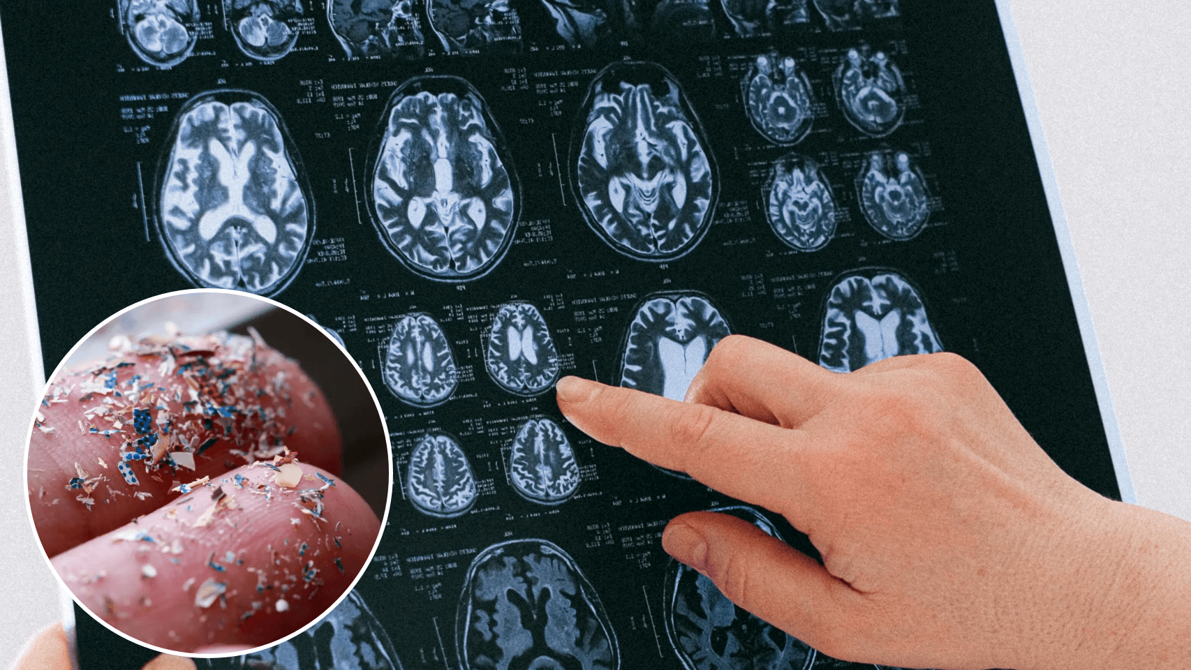 Capitalismo tóxico: 250 gramos de plástico al año dañan nuestro cerebro